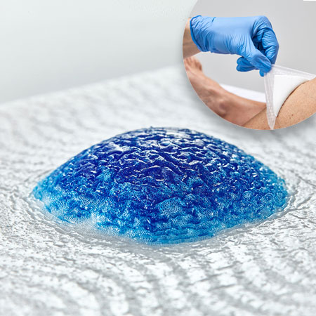 Image of a bandaged leg being cared for by a person wearing blue gloves